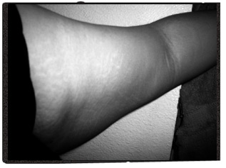 My upper arm, circa 2001.